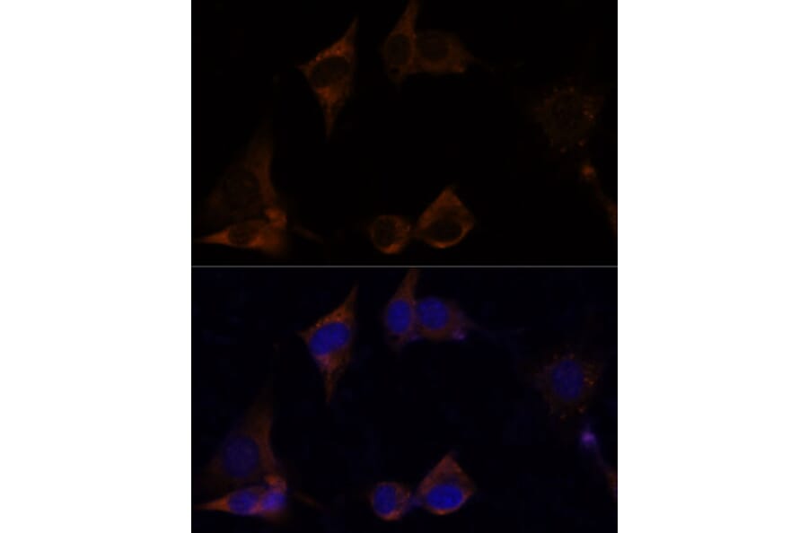 Immunofluorescence - Anti-IL-13 receptor alpha 2 Antibody (A309228) - Antibodies.com