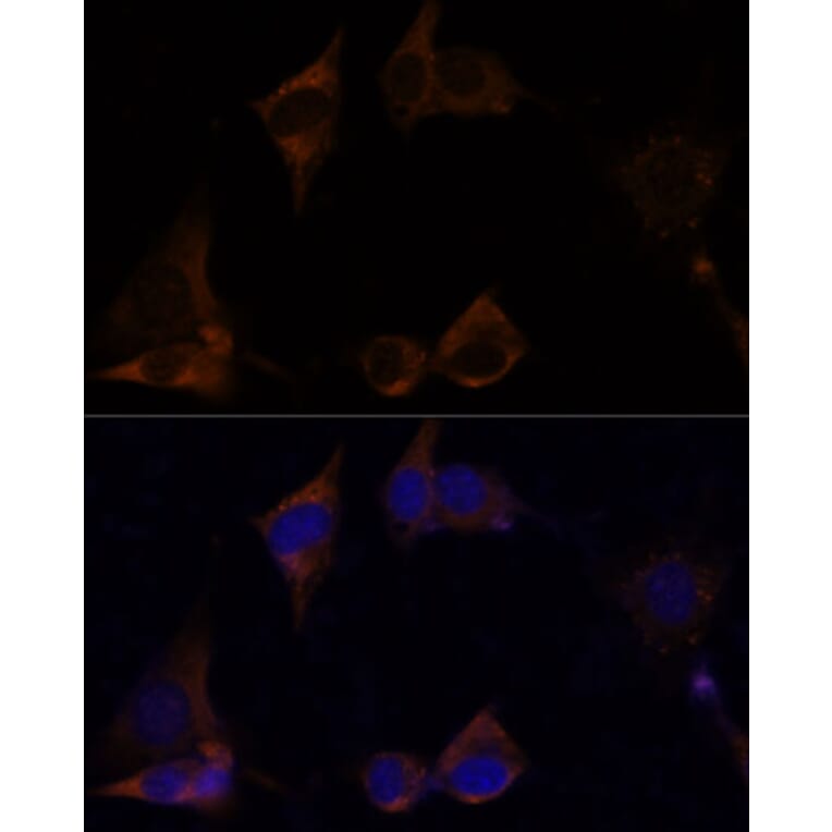Immunofluorescence - Anti-IL-13 receptor alpha 2 Antibody (A309228) - Antibodies.com