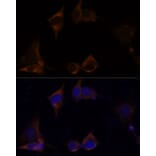 Immunofluorescence - Anti-IL-13 receptor alpha 2 Antibody (A309228) - Antibodies.com