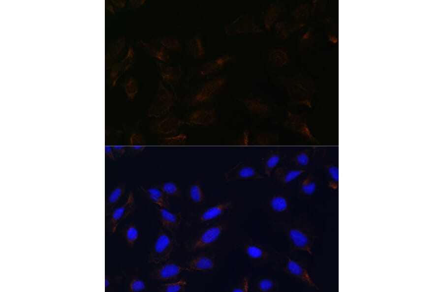 Immunofluorescence - Anti-IL-13 receptor alpha 2 Antibody (A309228) - Antibodies.com