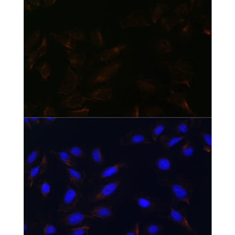 Immunofluorescence - Anti-IL-13 receptor alpha 2 Antibody (A309228) - Antibodies.com