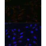 Immunofluorescence - Anti-IL-13 receptor alpha 2 Antibody (A309228) - Antibodies.com