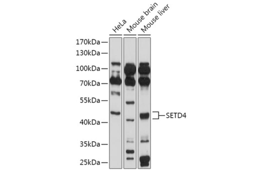 Western Blot - Anti-SETD4 Antibody (A309229) - Antibodies.com