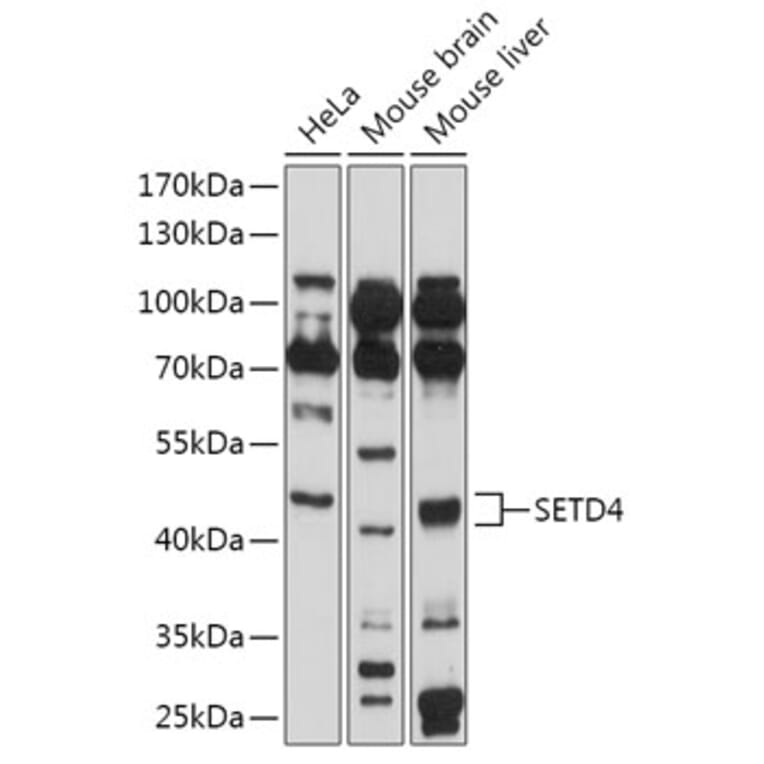 Western Blot - Anti-SETD4 Antibody (A309229) - Antibodies.com