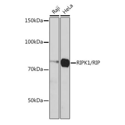 Western Blot - Anti-RIP Antibody [ARC0059] (A309230) - Antibodies.com