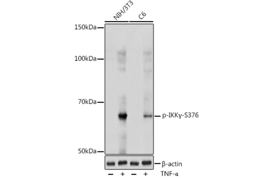 Western Blot - Anti-IKK gamma/NEMO (phospho Ser376) Antibody (A309231) - Antibodies.com