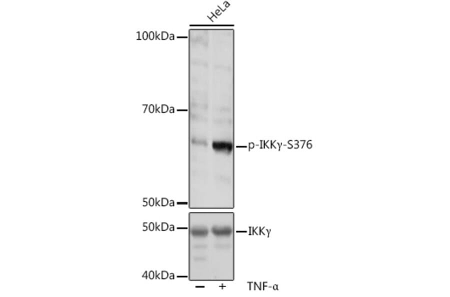 Western Blot - Anti-IKK gamma/NEMO (phospho Ser376) Antibody (A309231) - Antibodies.com