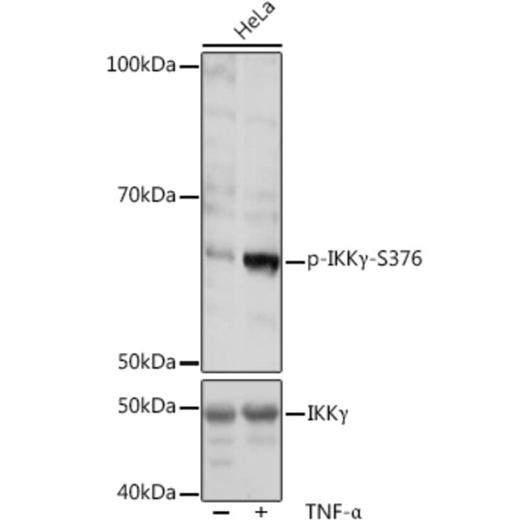 Western Blot - Anti-IKK gamma/NEMO (phospho Ser376) Antibody (A309231) - Antibodies.com