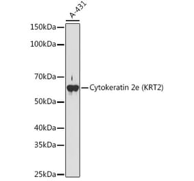 Western Blot - Anti-Cytokeratin 2e Antibody [ARC1925] (A309233) - Antibodies.com