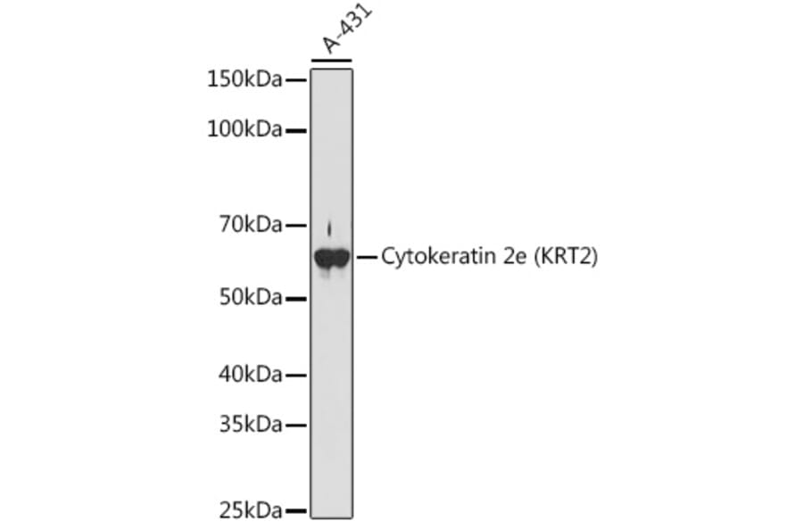 Western Blot - Anti-Cytokeratin 2e Antibody [ARC1925] (A309233) - Antibodies.com