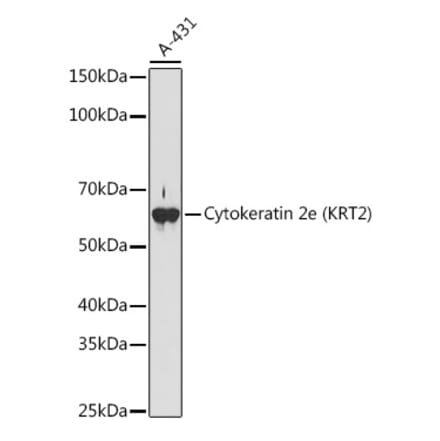 Western Blot - Anti-Cytokeratin 2e Antibody [ARC1925] (A309233) - Antibodies.com