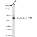 Western Blot - Anti-Cytokeratin 2e Antibody [ARC1925] (A309233) - Antibodies.com