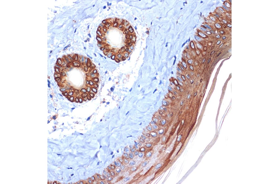 Immunohistochemistry - Anti-Cytokeratin 2e Antibody [ARC1925] (A309233) - Antibodies.com