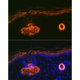 Immunofluorescence - Anti-Cytokeratin 2e Antibody [ARC1925] (A309233) - Antibodies.com