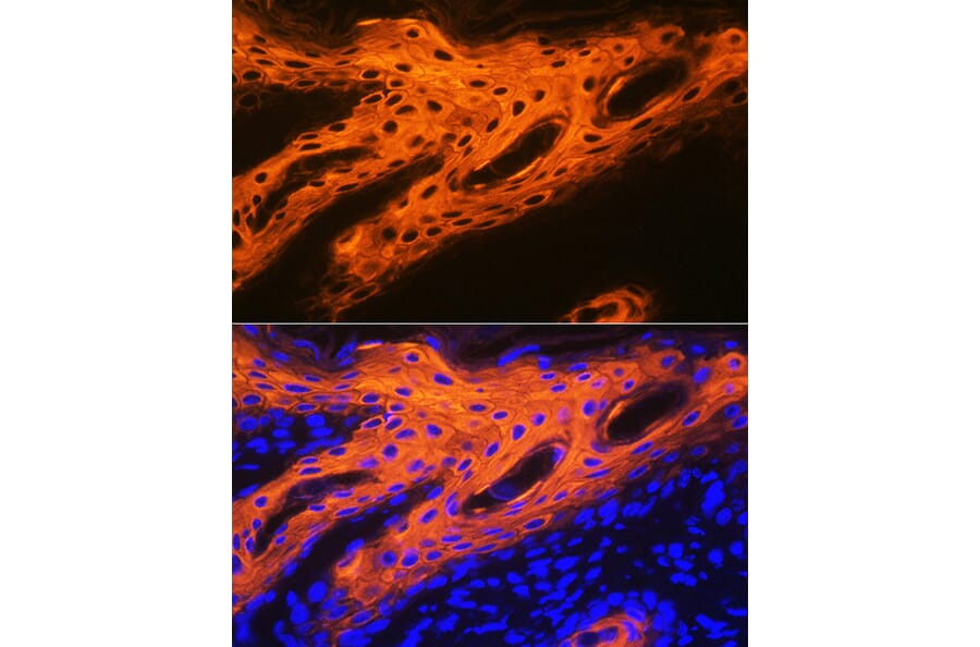 Immunofluorescence - Anti-Cytokeratin 2e Antibody [ARC1925] (A309233) - Antibodies.com