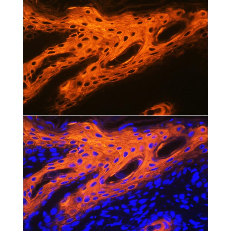 Immunofluorescence - Anti-Cytokeratin 2e Antibody [ARC1925] (A309233) - Antibodies.com