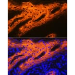 Immunofluorescence - Anti-Cytokeratin 2e Antibody [ARC1925] (A309233) - Antibodies.com