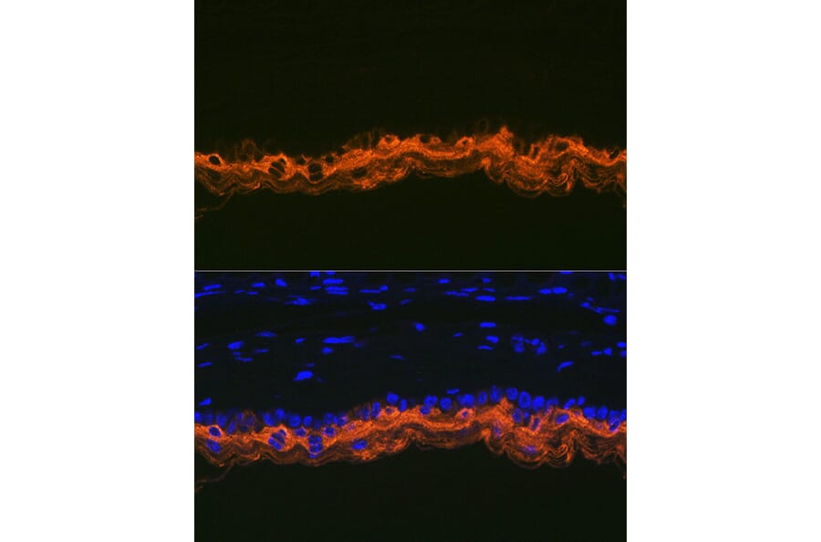 Immunofluorescence - Anti-Cytokeratin 2e Antibody [ARC1925] (A309233) - Antibodies.com