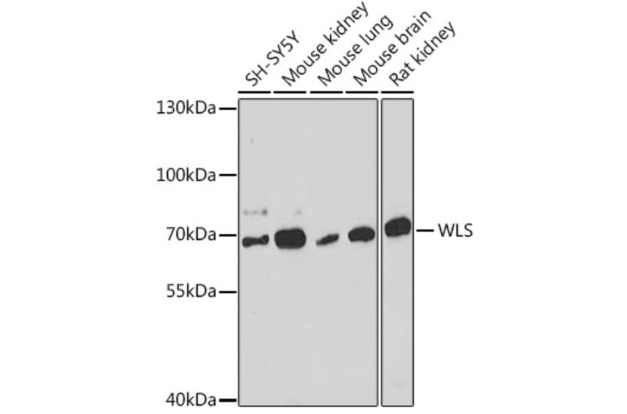 Western Blot - Anti-GPR177/WLS Antibody (A309235) - Antibodies.com