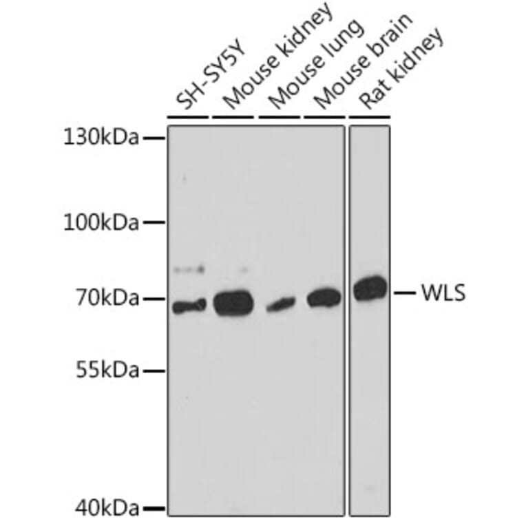 Western Blot - Anti-GPR177/WLS Antibody (A309235) - Antibodies.com