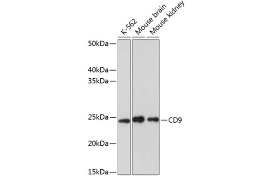 Western Blot - Anti-CD9 Antibody [ARC0330] (A309237) - Antibodies.com
