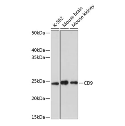 Western Blot - Anti-CD9 Antibody [ARC0330] (A309237) - Antibodies.com