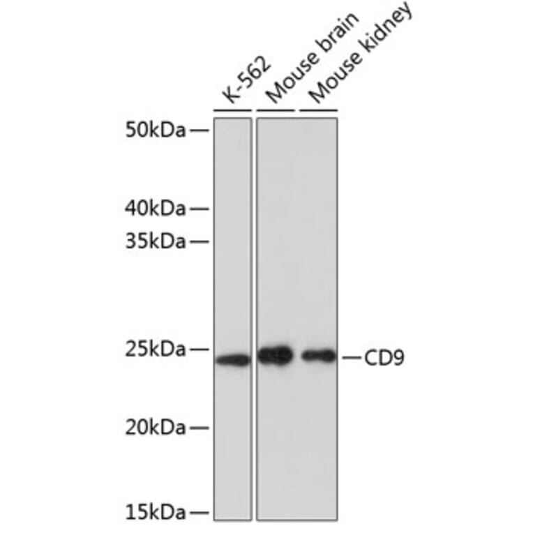 Western Blot - Anti-CD9 Antibody [ARC0330] (A309237) - Antibodies.com