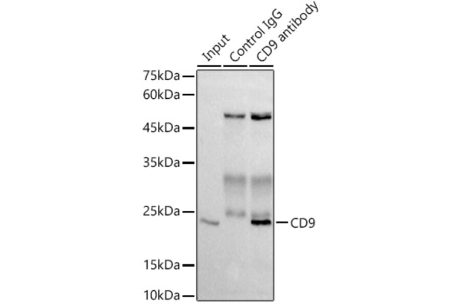 Western Blot - Anti-CD9 Antibody [ARC0330] (A309237) - Antibodies.com