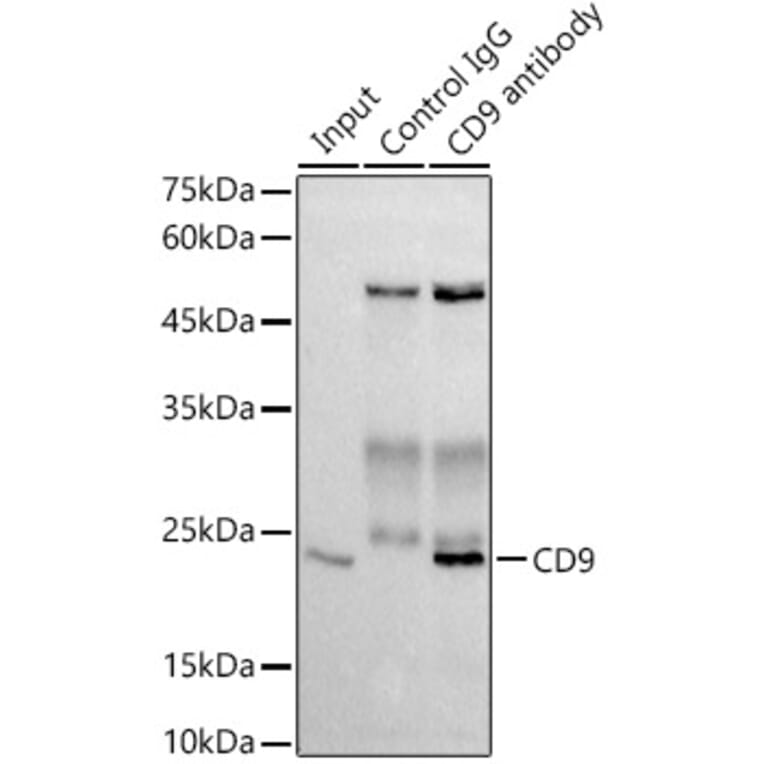 Western Blot - Anti-CD9 Antibody [ARC0330] (A309237) - Antibodies.com