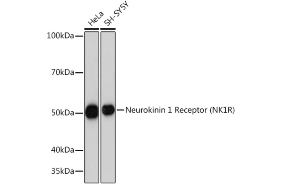 Western Blot - Anti-NK-1R Antibody [ARC1088] (A309238) - Antibodies.com
