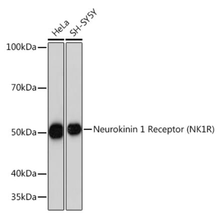 Western Blot - Anti-NK-1R Antibody [ARC1088] (A309238) - Antibodies.com