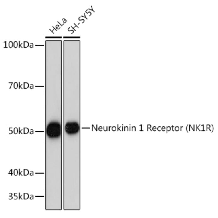Western Blot - Anti-NK-1R Antibody [ARC1088] (A309238) - Antibodies.com