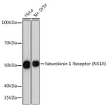 Western Blot - Anti-NK-1R Antibody [ARC1088] (A309238) - Antibodies.com