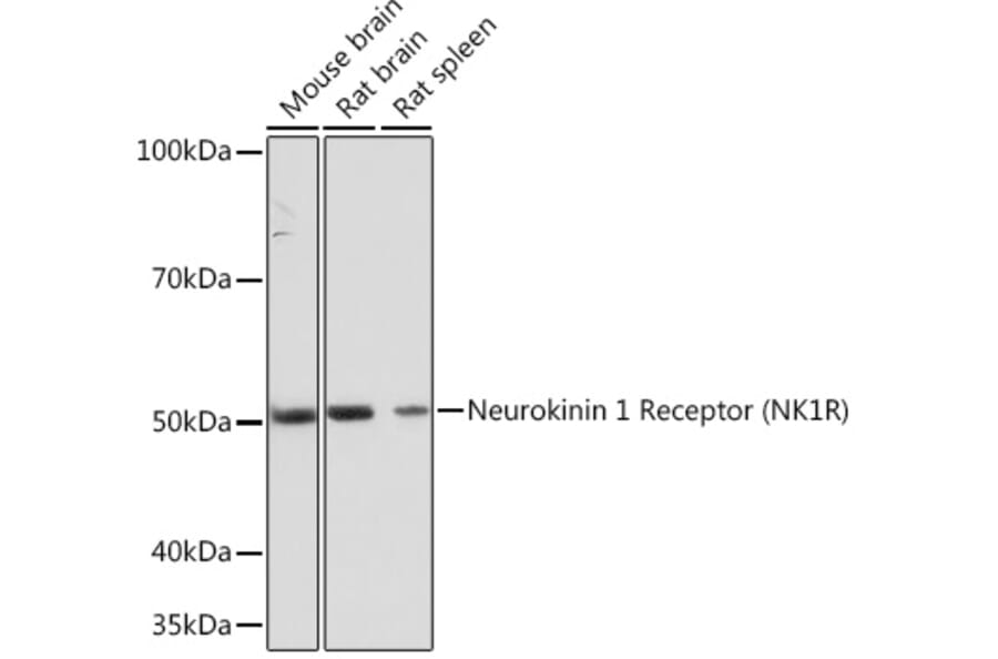 Western Blot - Anti-NK-1R Antibody [ARC1088] (A309238) - Antibodies.com