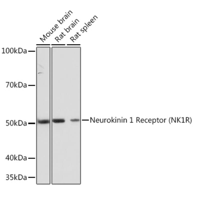 Western Blot - Anti-NK-1R Antibody [ARC1088] (A309238) - Antibodies.com