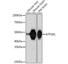 Western Blot - Anti-ATP1B1 Antibody [ARC1232] (A309240) - Antibodies.com