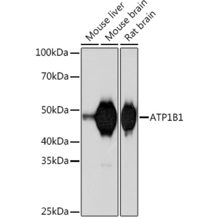 Western Blot - Anti-ATP1B1 Antibody [ARC1232] (A309240) - Antibodies.com