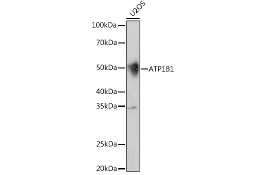 Western Blot - Anti-ATP1B1 Antibody [ARC1232] (A309240) - Antibodies.com