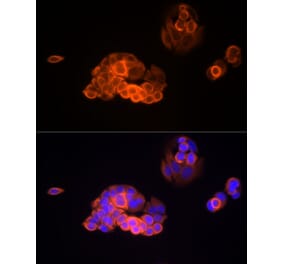 Immunofluorescence - Anti-MMP13 Antibody [ARC51250] (A309241) - Antibodies.com