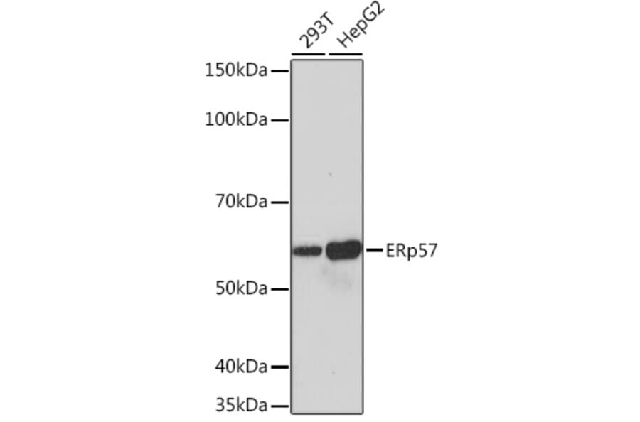 Western Blot - Anti-ERp57 Antibody [ARC0987] (A309243) - Antibodies.com