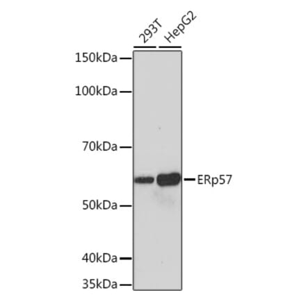 Western Blot - Anti-ERp57 Antibody [ARC0987] (A309243) - Antibodies.com