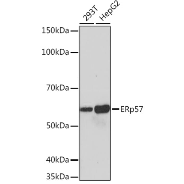 Western Blot - Anti-ERp57 Antibody [ARC0987] (A309243) - Antibodies.com