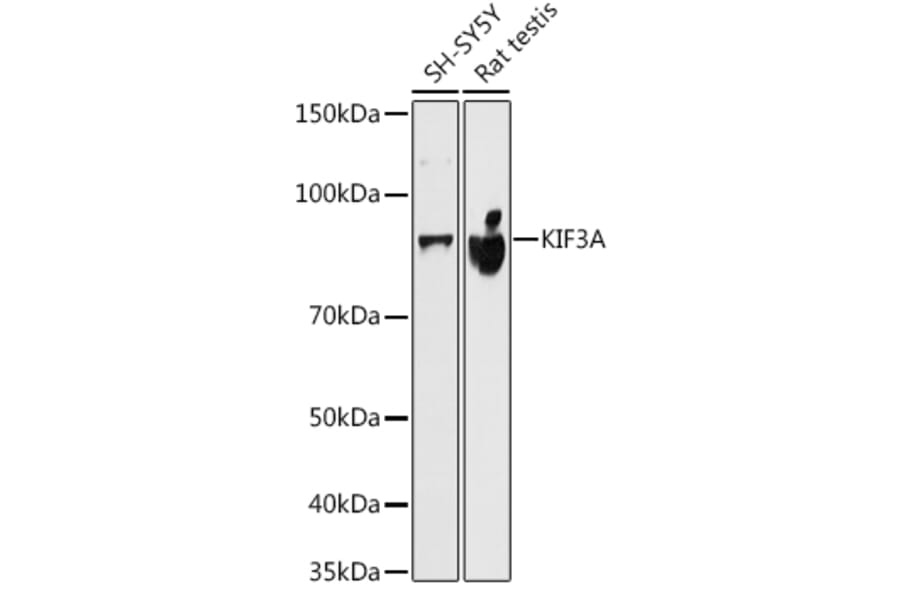 Western Blot - Anti-KIF3A Antibody [ARC1428] (A309246) - Antibodies.com