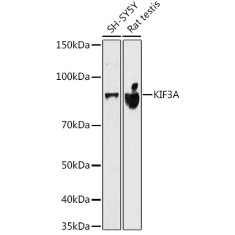 Western Blot - Anti-KIF3A Antibody [ARC1428] (A309246) - Antibodies.com