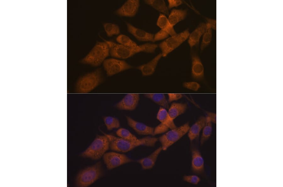 Immunofluorescence - Anti-KIF3A Antibody [ARC1428] (A309246) - Antibodies.com