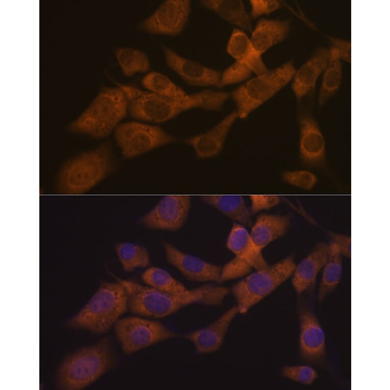 Immunofluorescence - Anti-KIF3A Antibody [ARC1428] (A309246) - Antibodies.com