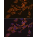Immunofluorescence - Anti-KIF3A Antibody [ARC1428] (A309246) - Antibodies.com