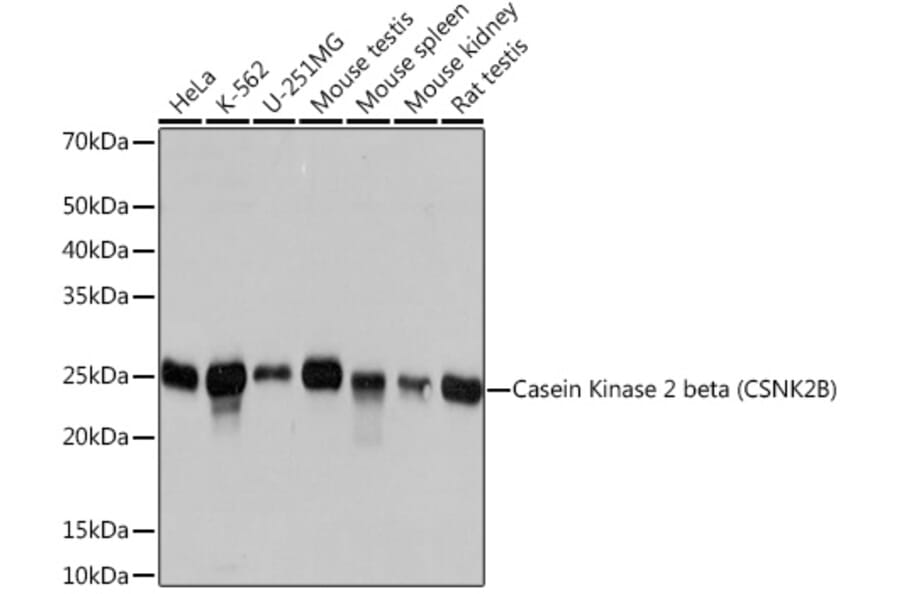 Western Blot - Anti-Casein Kinase 2 beta Antibody [ARC1069] (A309247) - Antibodies.com