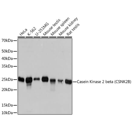 Western Blot - Anti-Casein Kinase 2 beta Antibody [ARC1069] (A309247) - Antibodies.com