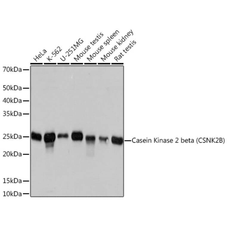 Western Blot - Anti-Casein Kinase 2 beta Antibody [ARC1069] (A309247) - Antibodies.com